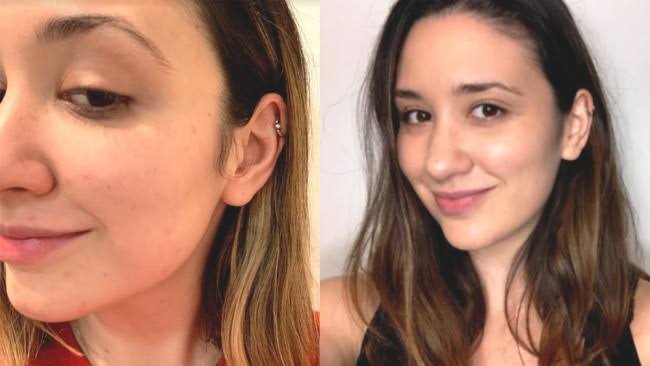Collagen Supplements for Skin: Do They Actually Work?
